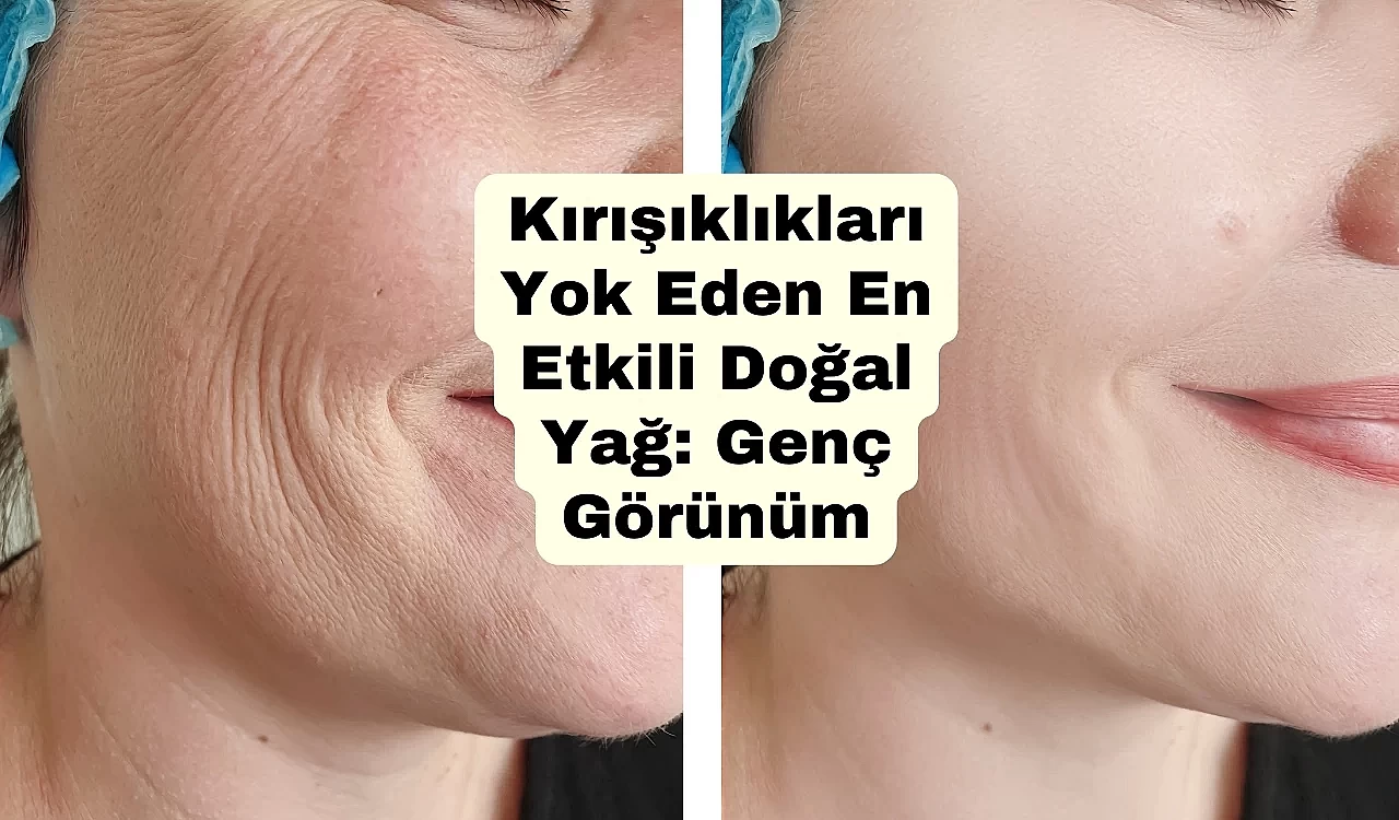 Kırışıklıkları Yok Eden En Etkili Doğal Yağ: Genç Görünüm