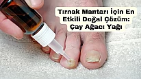 Tırnak Mantarı İçin En Etkili Doğal Çözüm: Çay Ağacı Yağı