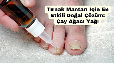 Tırnak Mantarı İçin En Etkili Doğal Çözüm: Çay Ağacı Yağı