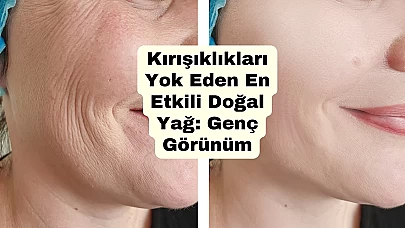 Kırışıklıkları Yok Eden En Etkili Doğal Yağ: Genç Görünüm