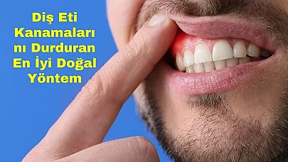 Diş Eti Kanamalarını Durduran En İyi Doğal Yöntem