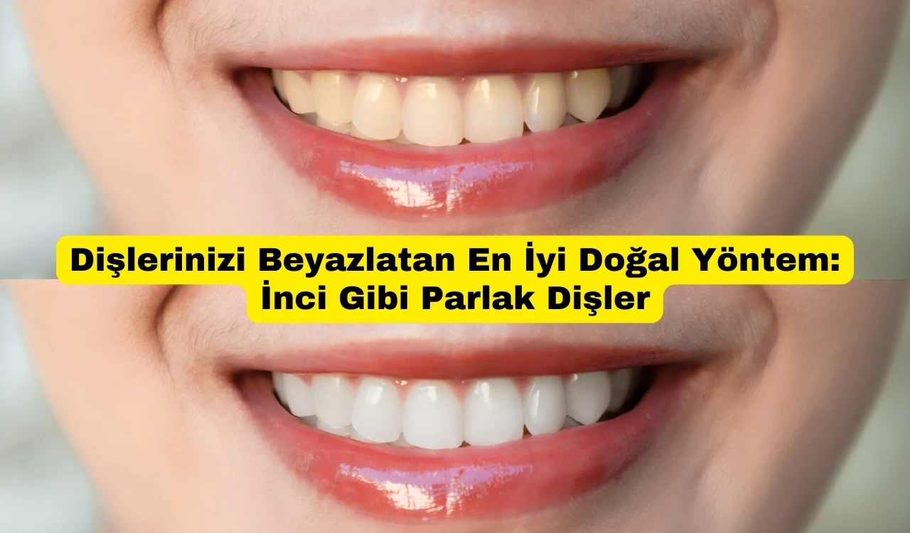 Dişlerinizi Beyazlatan En İyi Doğal Yöntem: İnci Gibi Parlak Dişler